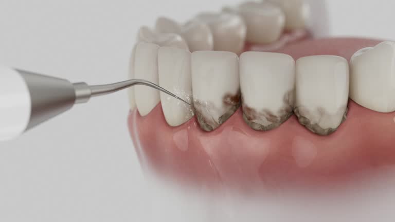 Reliable Dental Implants contractor in Foxfire, NC by Smile Center Dentistry